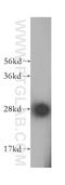 Sepiapterin Reductase antibody, 16822-1-AP, Proteintech Group, Western Blot image 