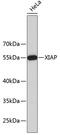 X-Linked Inhibitor Of Apoptosis antibody, 19-141, ProSci, Western Blot image 