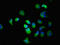 Solute Carrier Family 22 Member 2 antibody, orb400232, Biorbyt, Immunofluorescence image 