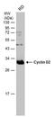 Cyclin D2 antibody, PA5-77890, Invitrogen Antibodies, Western Blot image 