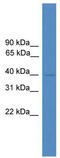 Nuclear Factor, Erythroid 2 antibody, TA329221, Origene, Western Blot image 