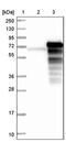 NADH:Ubiquinone Oxidoreductase Subunit V3 antibody, PA5-54216, Invitrogen Antibodies, Western Blot image 