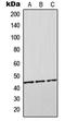 Orosomucoid 2 antibody, LS-C352611, Lifespan Biosciences, Western Blot image 