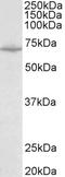 Solute Carrier Family 6 Member 8 antibody, LS-B9535, Lifespan Biosciences, Western Blot image 