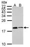 Actin Related Protein 2/3 Complex Subunit 5 antibody, PA5-30352, Invitrogen Antibodies, Western Blot image 