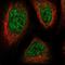 Chromosome 3 Open Reading Frame 33 antibody, NBP1-90874, Novus Biologicals, Immunofluorescence image 