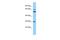 RAB19, Member RAS Oncogene Family antibody, A15589, Boster Biological Technology, Western Blot image 