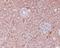 Apoptotic Peptidase Activating Factor 1 antibody, M00889, Boster Biological Technology, Immunohistochemistry paraffin image 