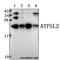 ATP Synthase Membrane Subunit G Like antibody, A18728-1, Boster Biological Technology, Western Blot image 