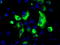 Protein-lysine 6-oxidase antibody, LS-C114932, Lifespan Biosciences, Immunofluorescence image 