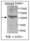 ACK1 antibody, AP31749PU-N, Origene, Western Blot image 