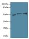 Sialic acid-binding Ig-like lectin 6 antibody, LS-C376620, Lifespan Biosciences, Western Blot image 