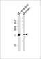 H3 Histone Family Member 3B antibody, M06819-30, Boster Biological Technology, Western Blot image 