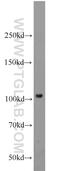 Nucleotide Binding Oligomerization Domain Containing 2 antibody, 20980-1-AP, Proteintech Group, Western Blot image 