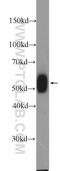 LCK Proto-Oncogene, Src Family Tyrosine Kinase antibody, 24497-1-AP, Proteintech Group, Western Blot image 