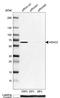 Histone Deacetylase 2 antibody, NBP1-87109, Novus Biologicals, Western Blot image 