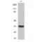 Cyclin Dependent Kinase 1 antibody, LS-C382617, Lifespan Biosciences, Western Blot image 