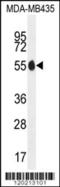 Paired box protein Pax-1 antibody, 55-998, ProSci, Western Blot image 