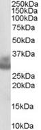 Cathepsin F antibody, EB06733, Everest Biotech, Western Blot image 