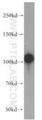 Actinin Alpha 4 antibody, 19096-1-AP, Proteintech Group, Western Blot image 