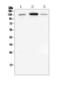 Cadherin 1 antibody, M00063-2, Boster Biological Technology, Western Blot image 