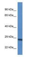 RAB6C, Member RAS Oncogene Family antibody, NBP1-74265, Novus Biologicals, Western Blot image 