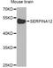 Serpin Family A Member 12 antibody, A8074, ABclonal Technology, Western Blot image 