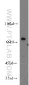 Non-receptor tyrosine-protein kinase TNK1 antibody, 14199-1-AP, Proteintech Group, Western Blot image 