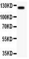 TEK Receptor Tyrosine Kinase antibody, RP1036, Boster Biological Technology, Western Blot image 