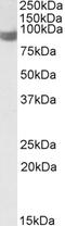 Phospholipase A2 Group IVA antibody, EB10113, Everest Biotech, Western Blot image 