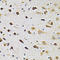 G Protein-Coupled Receptor Kinase 2 antibody, LS-C331619, Lifespan Biosciences, Immunohistochemistry frozen image 