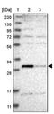 Thiamine Triphosphatase antibody, PA5-55998, Invitrogen Antibodies, Western Blot image 