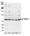 Poly(ADP-Ribose) Polymerase Family Member 12 antibody, A305-130A, Bethyl Labs, Western Blot image 