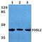 FOS Like 2, AP-1 Transcription Factor Subunit antibody, A02615S301, Boster Biological Technology, Western Blot image 