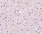 Presenilin 1 antibody, NBP1-76792, Novus Biologicals, Immunohistochemistry frozen image 