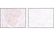 Histone chaperone ASF1A antibody, 2990S, Cell Signaling Technology, Immunohistochemistry paraffin image 