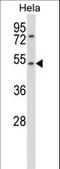 Cholinergic Receptor Nicotinic Alpha 7 Subunit antibody, LS-C168756, Lifespan Biosciences, Western Blot image 