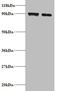 Spermidine/Spermine N1-Acetyltransferase 1 antibody, A53921-100, Epigentek, Western Blot image 