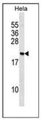 Poly(A) Binding Protein Interacting Protein 2 antibody, AP53153PU-N, Origene, Western Blot image 