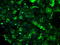 ATP Synthase F1 Subunit Beta antibody, LS-C114907, Lifespan Biosciences, Immunofluorescence image 