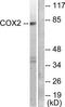 COX2 antibody, TA313292, Origene, Western Blot image 