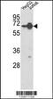 Heterogeneous Nuclear Ribonucleoprotein L antibody, MBS9201602, MyBioSource, Western Blot image 