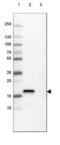 Claudin 1 antibody, NBP2-61630, Novus Biologicals, Western Blot image 