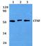 Cathepsin F antibody, PA5-75772, Invitrogen Antibodies, Western Blot image 