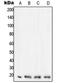 Lag antibody, LS-C352444, Lifespan Biosciences, Western Blot image 