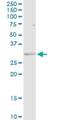 Major Histocompatibility Complex, Class II, DR Beta 5 antibody, H00003127-D01P, Novus Biologicals, Western Blot image 