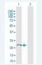 Transmembrane BAX Inhibitor Motif Containing 4 antibody, H00051643-B01P-50ug, Novus Biologicals, Western Blot image 