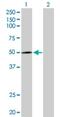 Cytochrome P450 Family 2 Subfamily R Member 1 antibody, H00120227-D01P, Novus Biologicals, Western Blot image 