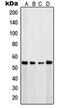 Phosphatase And Tensin Homolog antibody, orb214472, Biorbyt, Western Blot image 