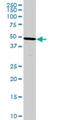 PPD antibody, H00003242-M07, Novus Biologicals, Western Blot image 